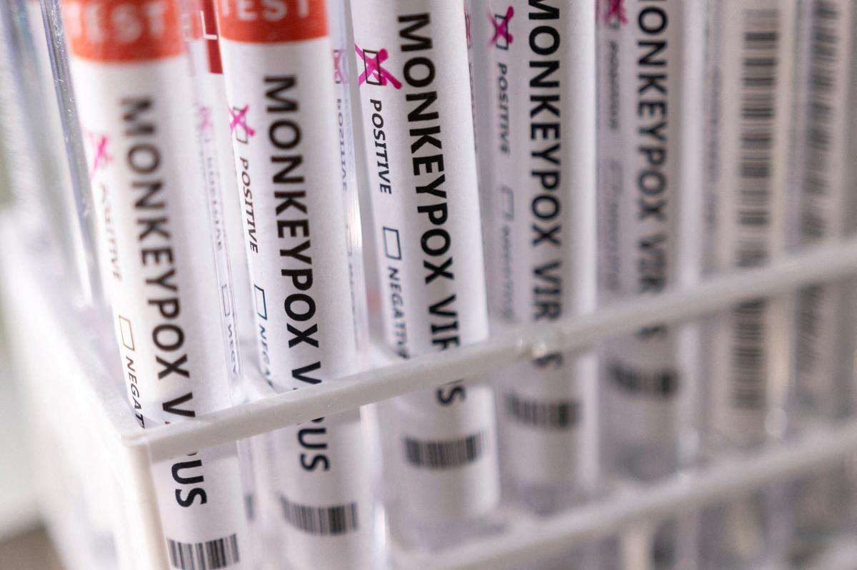 Monkeypox Outbreak